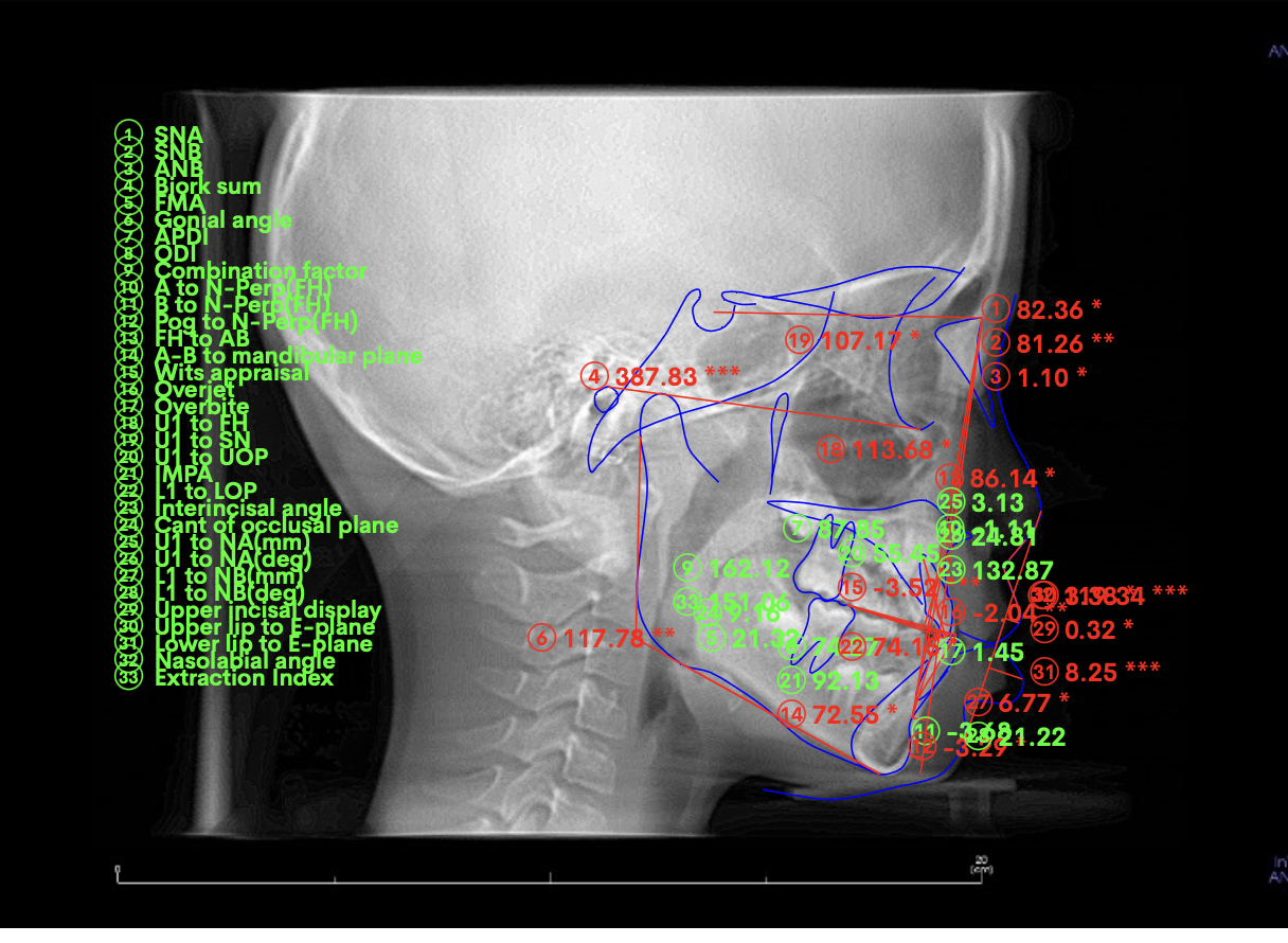 カラーアトラス　X線解剖学とセファロ分析法 シエン社 | カラーアトラスX線解剖学とセファロ分析法